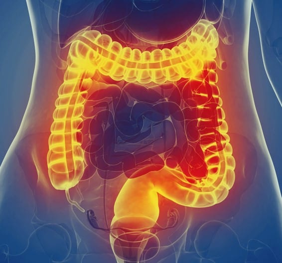 Acute Severe Ulcerative Colitis: A Medical & Surgical Emergency Requiring Comprehensive, Timely Care