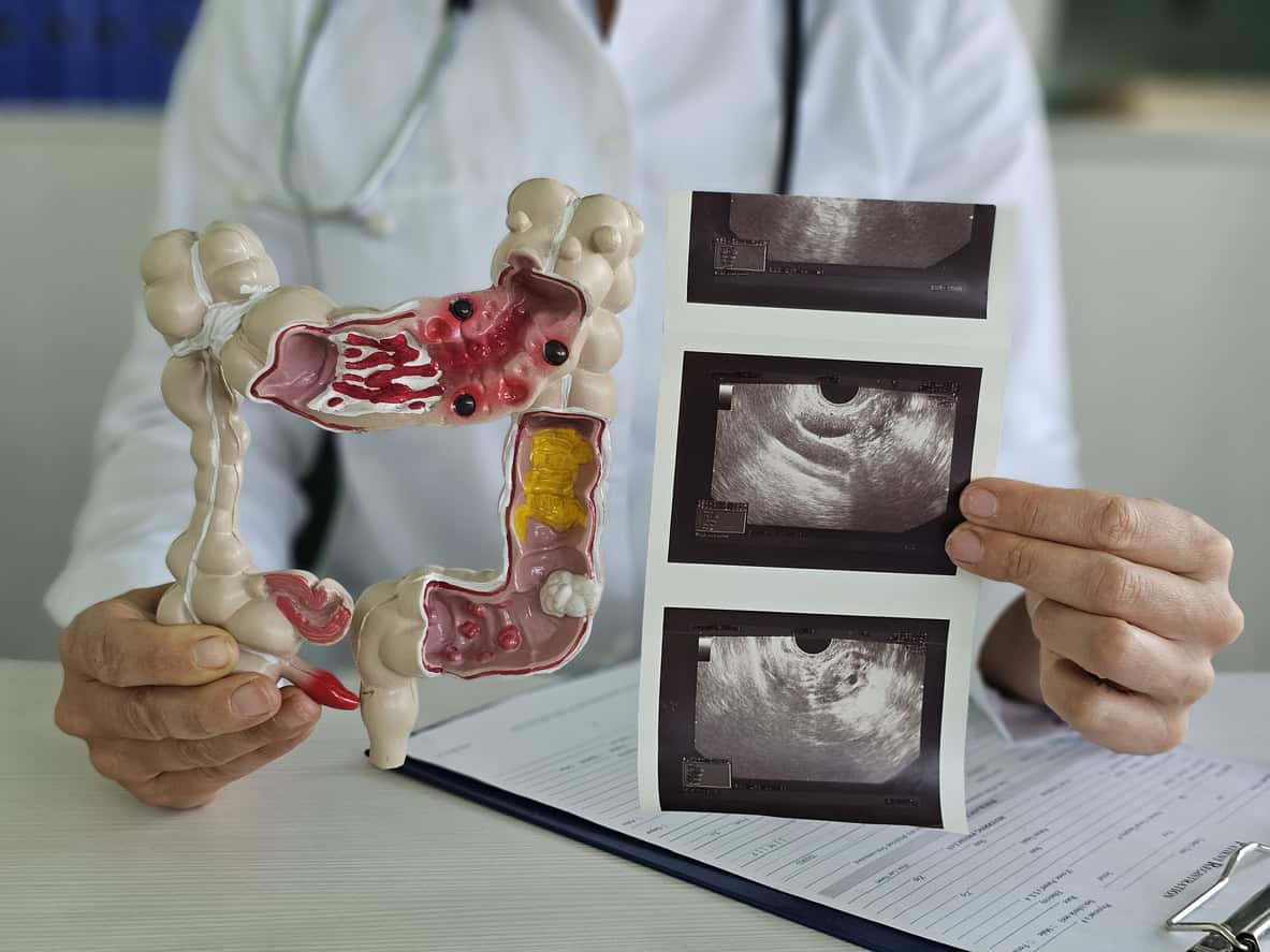 Doctor pointing to model of colon and holing ultrasound images.